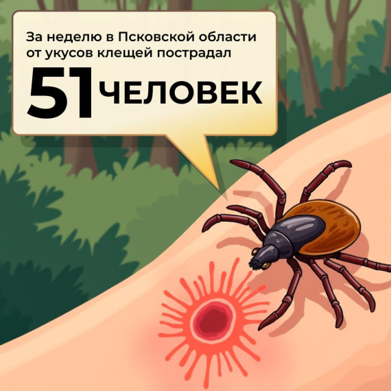 Согласно данным Управления Роспотребнадзора по Псковской области, с 3 по 9 апреля в медорганизации региона с жалобами на присасывания клещей обратились 51 человек, из них 20 – дети.. Согласно данным Управления Роспотребнадзора по Псковской области, с 3 по 9 апреля в медорганизации региона с жалобами на присасывания клещей обратились 51 человек, из них 20 – дети..